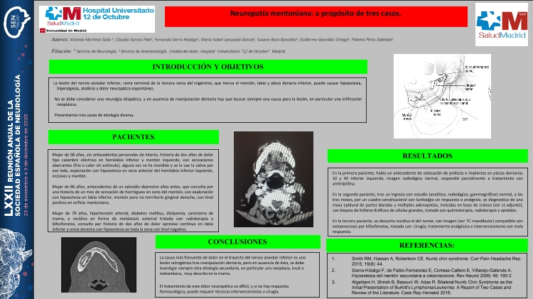 Neuropatía mentoniana: a propósito de tres casos.