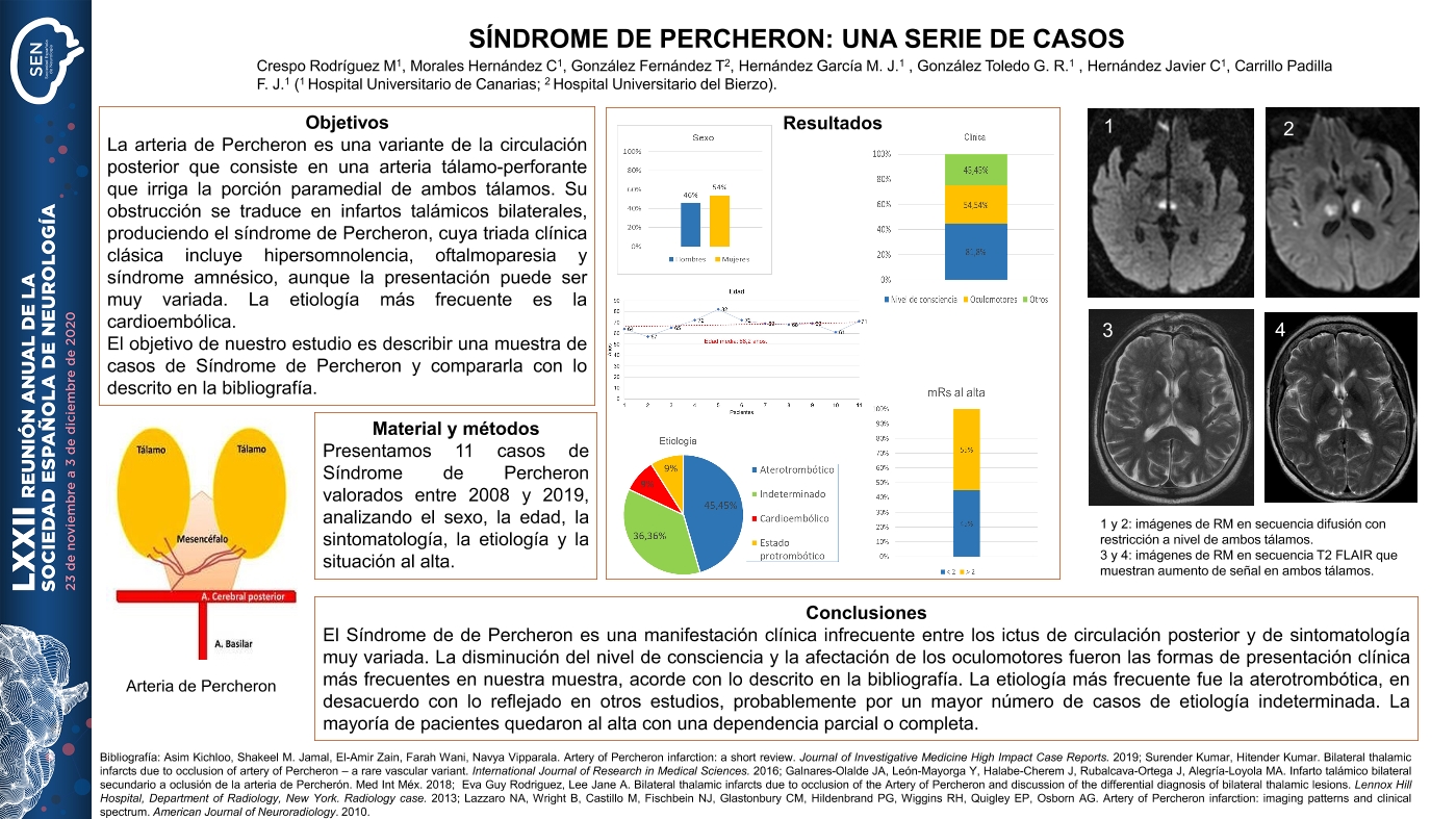 Síndrome de Percheron: una serie de casos