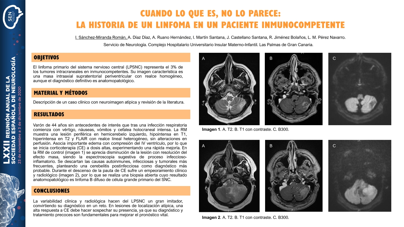 Cuando lo que es, no lo parece: La historia de un linfoma en un paciente inmunocompetente