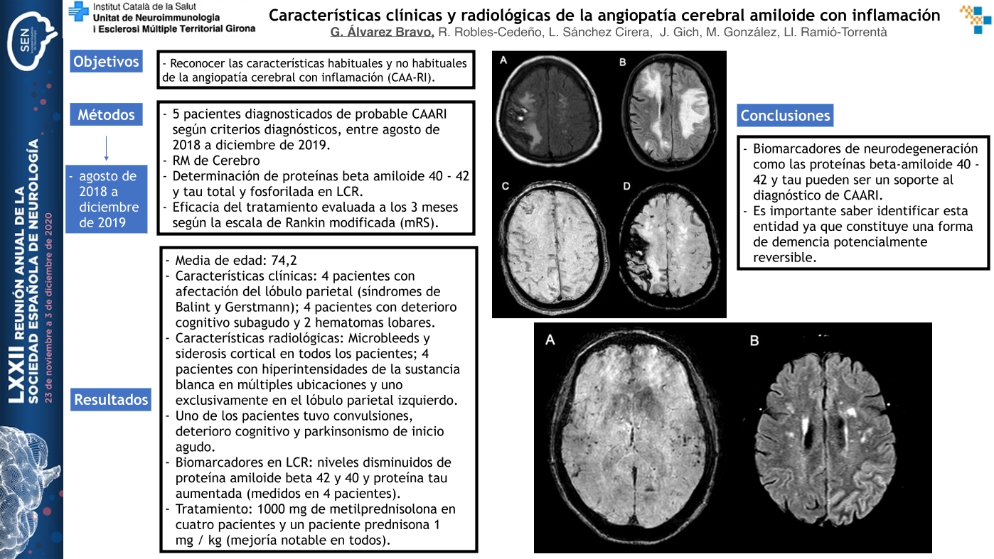 Características clínicas y radiológicas de la angiopatía cerebral amiloide con inflamación