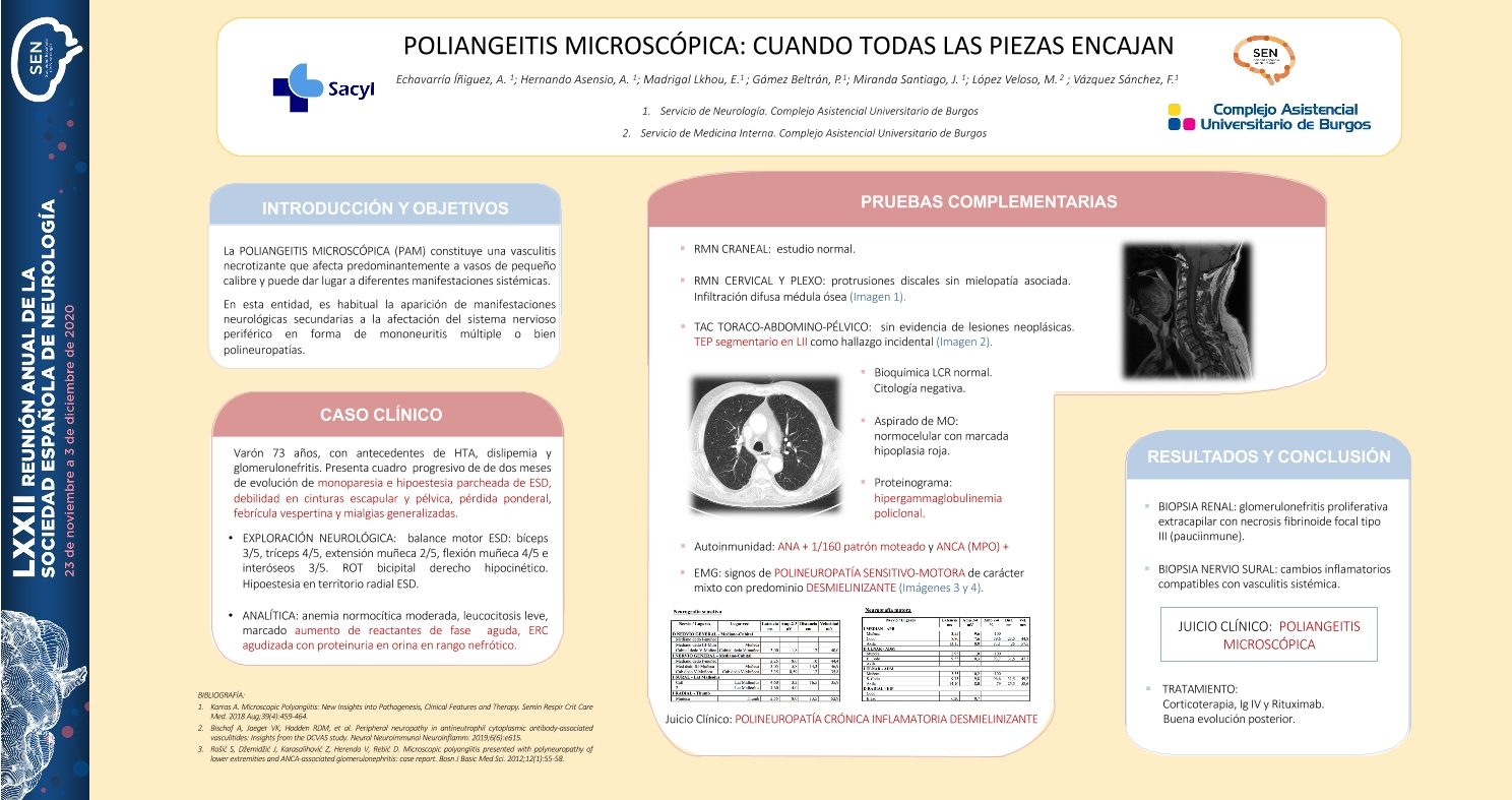 Poliangeitis microscópica: cuando todas las piezas encajan