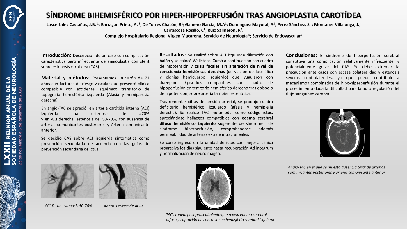 Síndrome bihemisférico por hiper-hipoperfusión tras angioplastia carotídea.