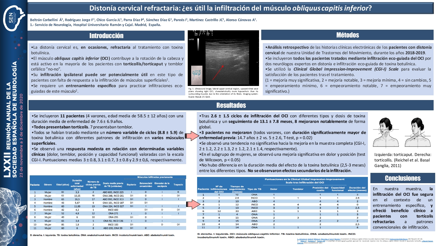 Distonía cervical refractaria y utilidad de la Infiltración del músculo obliquus capitis inferior