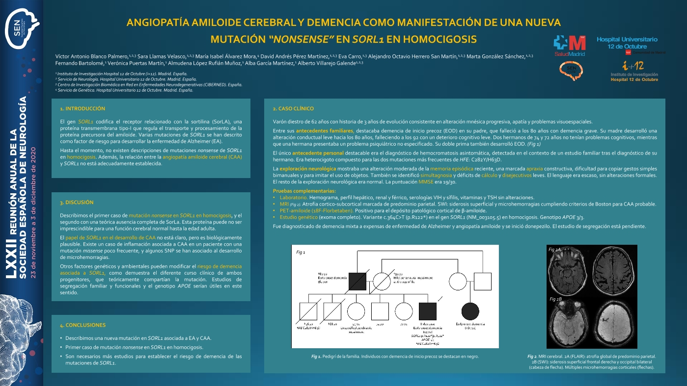 Angiopatía amiloide cerebral y demencia como manifestación de una nueva mutación “nonsense” en SORL1 en homocigosis