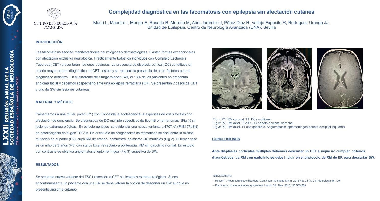 Complejidad diagnóstica en las facomatosis con epilepsia sin afectación cutánea