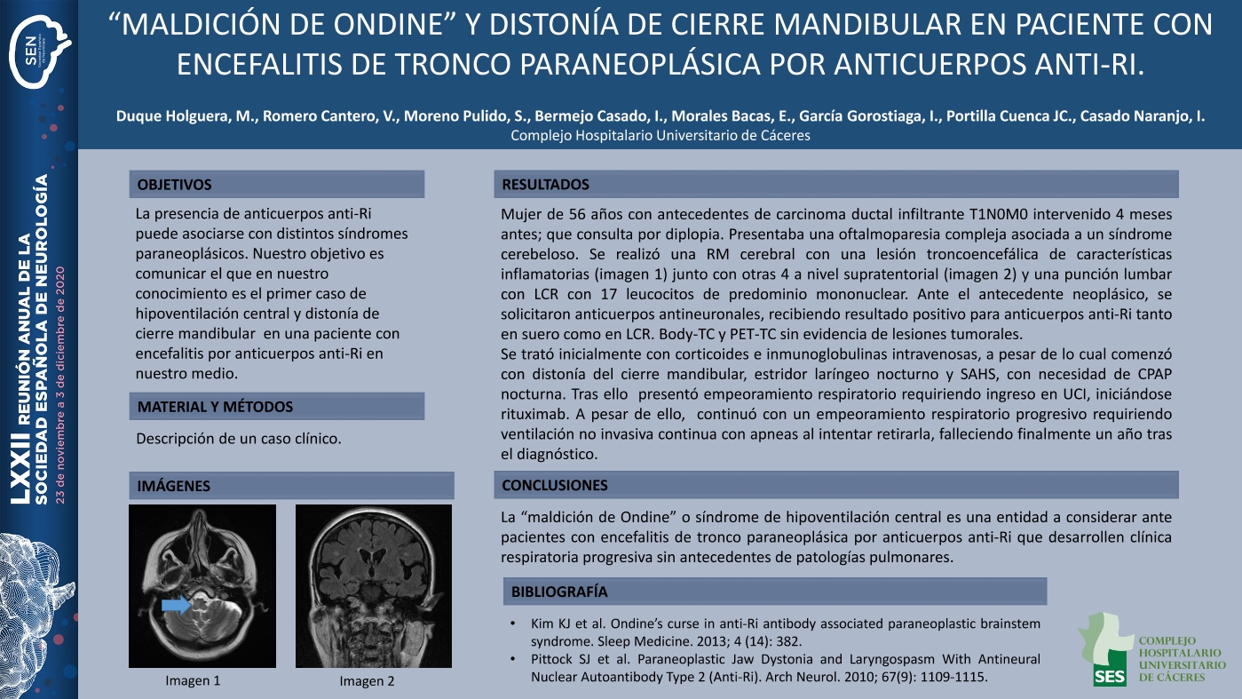 “Maldición de Ondine” y distonía de cierre mandibular en paciente con encefalitis de tronco paraneoplásica por anticuerpos anti-Ri.