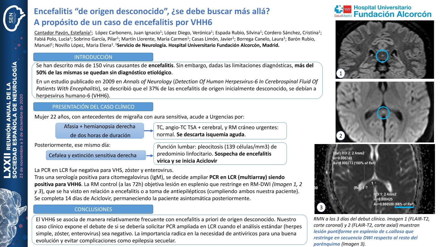 Encefalitis “de origen desconocido”, ¿se debe buscar más allá? A propósito de un caso de encefalitis por VHH6