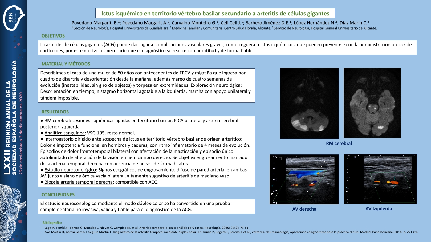 Ictus isquémico en territorio vértebro basilar secundario a arteritis de células gigantes