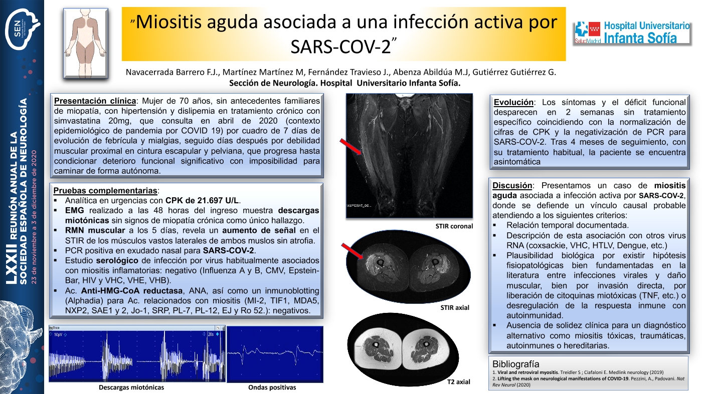 Miositis aguda asociada a una infección activa por SARS-CoV-2