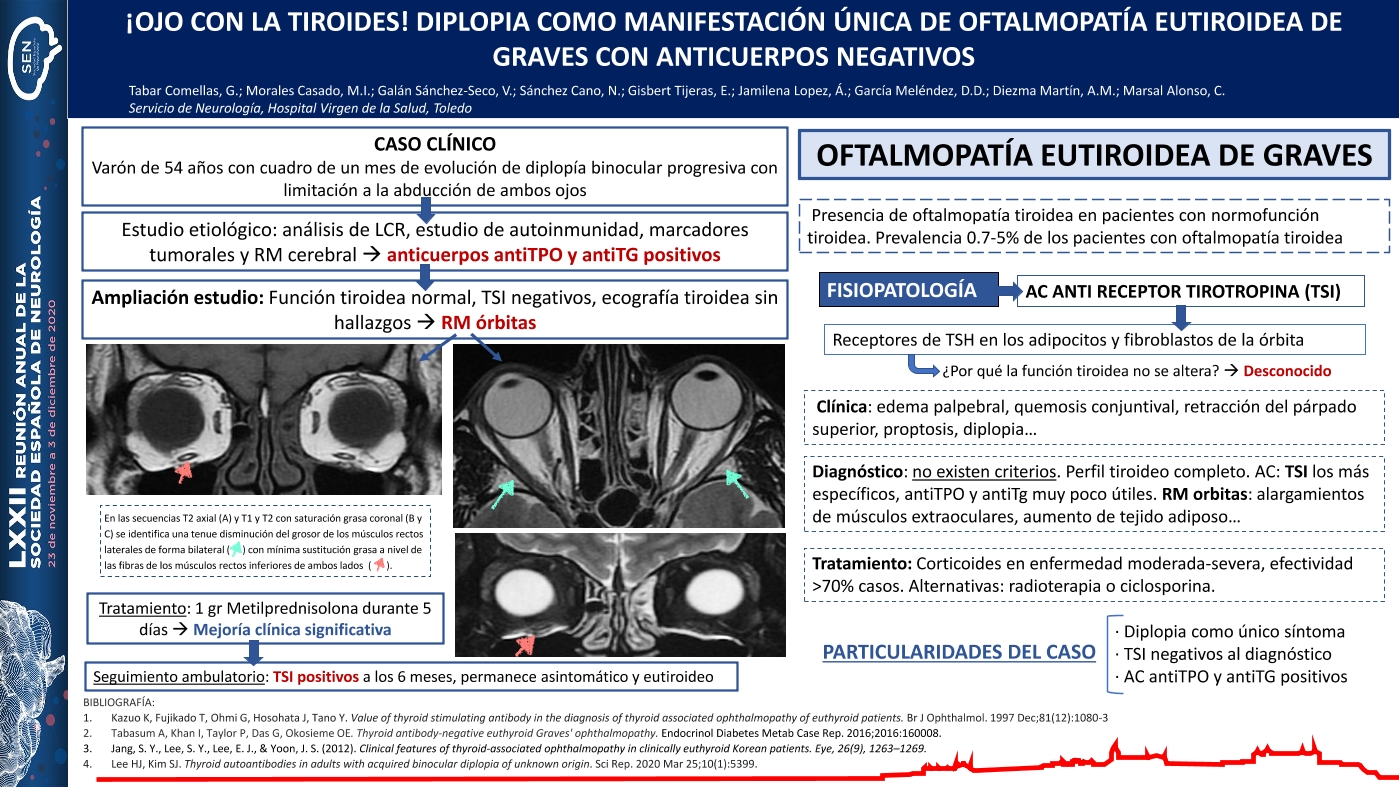 ¡Ojo con la tiroides! Diplopia como manifestación única de oftalmopatía eutiroidea de Graves con anticuerpos negativos