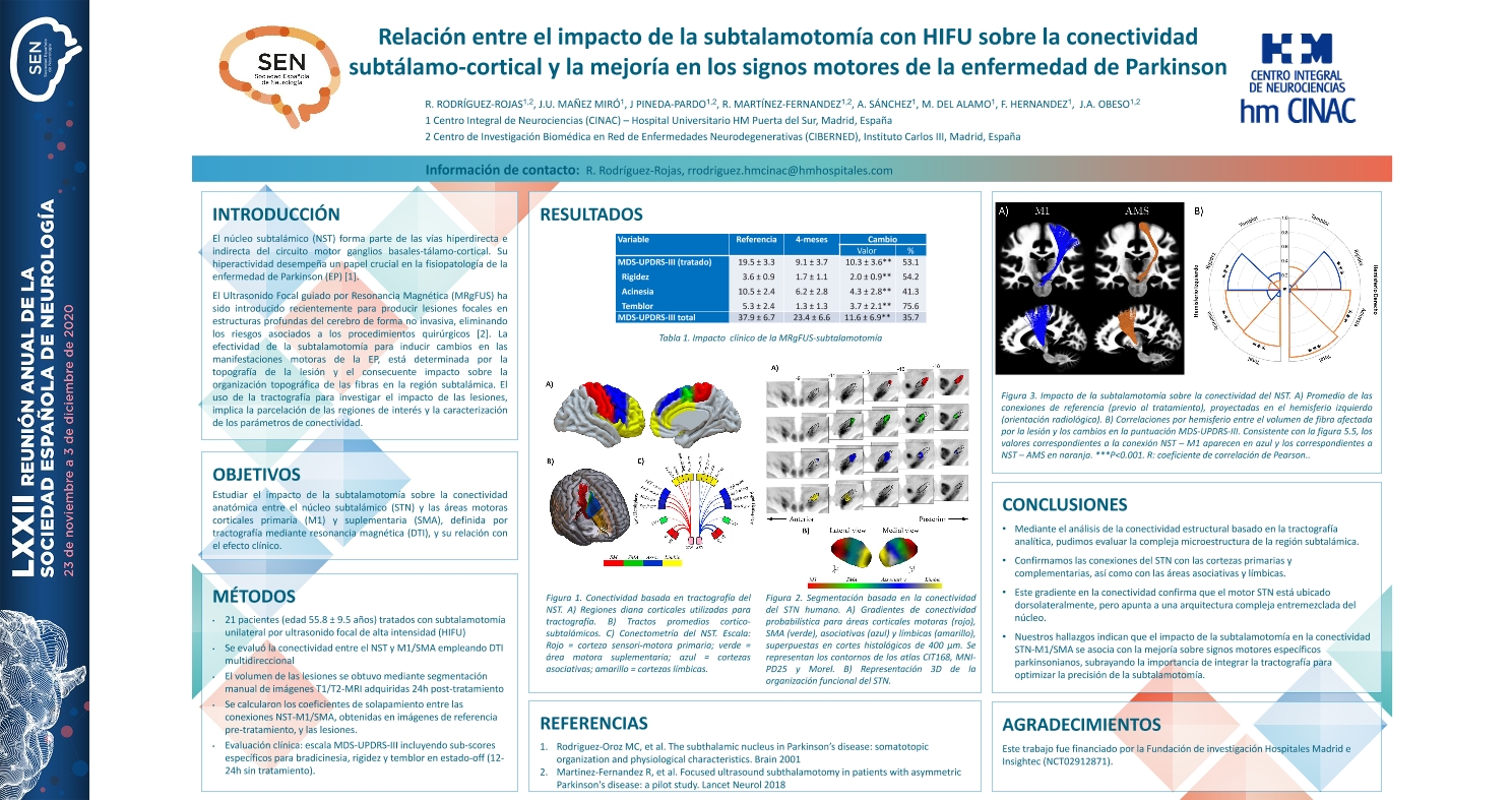 Relación entre el impacto de la subtalamotomía con HIFU sobre la conectividad subtálamo-cortical y la mejoría en los signos motores de la enfermedad de Parkinson