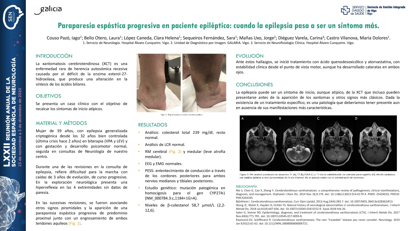 Paraparesia espástica progresiva en paciente epiléptico: cuando la epilepsia pasa a ser un síntoma más