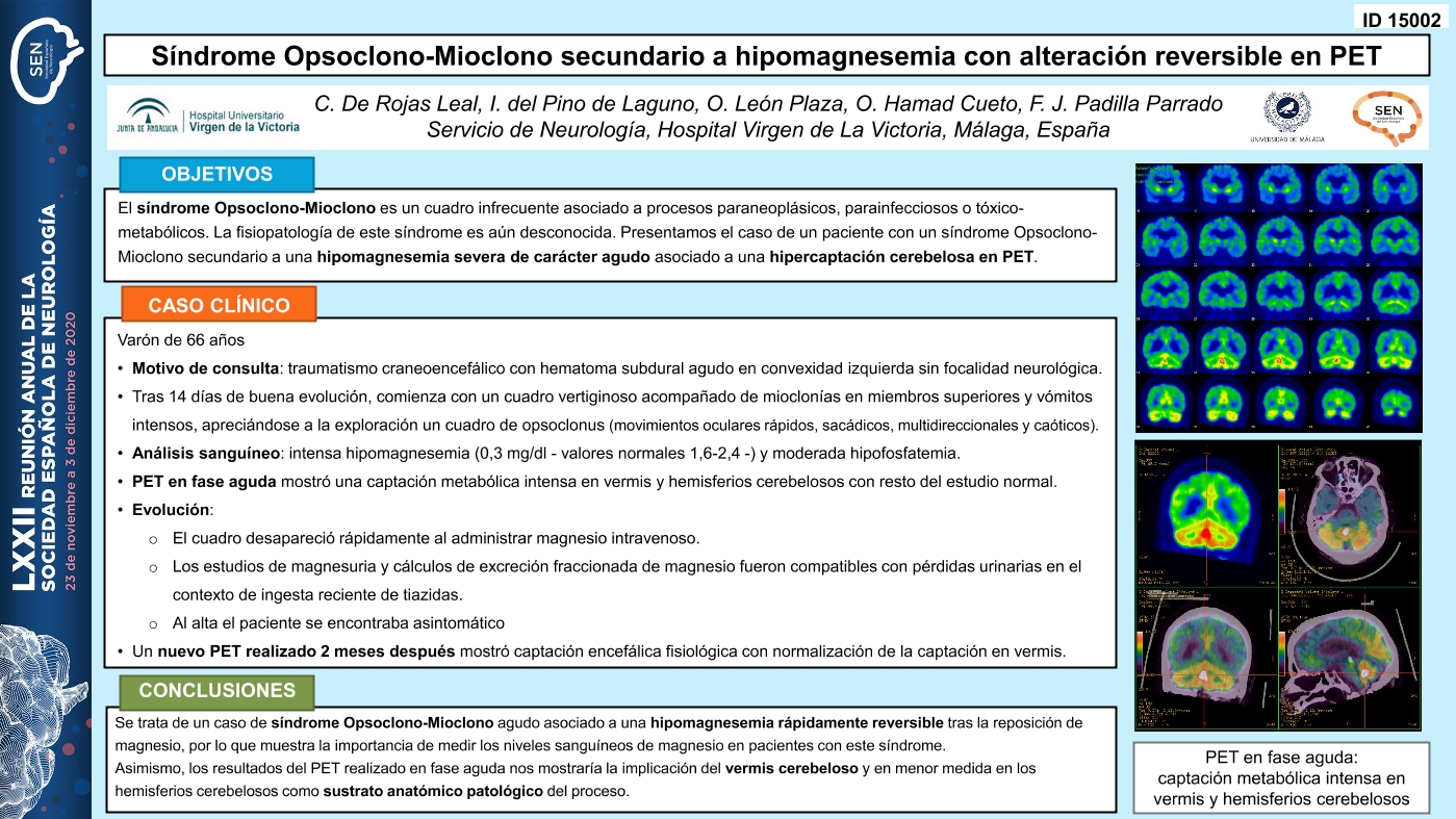 Síndrome Opsoclono-Mioclono secundario a hipomagnesemia con alteración reversible en PET