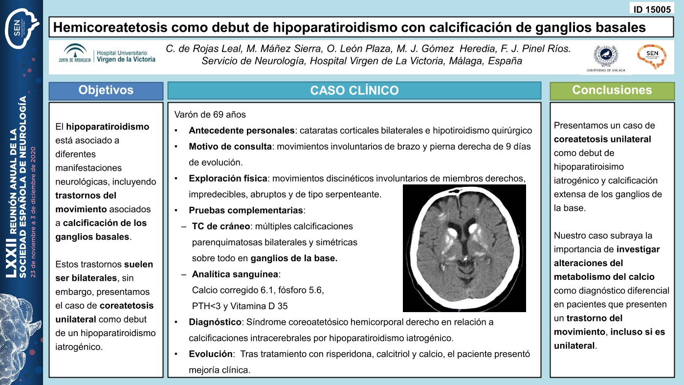 Hemicoreatetosis como debut de hipoparatiroidismo con calcificación de ganglios basales