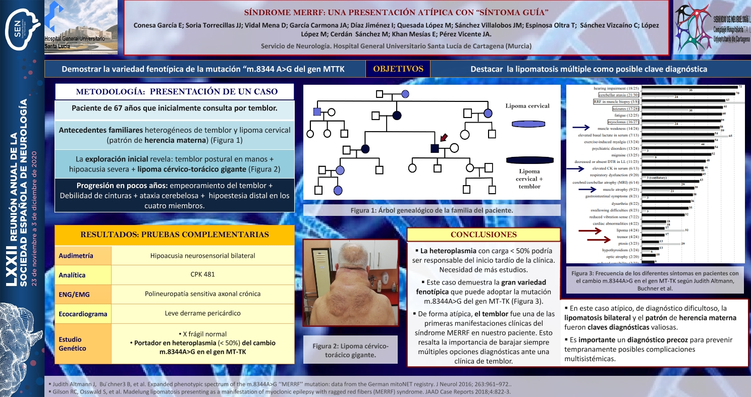 Síndrome MERRF: una presentación atípica con “síntoma guía”