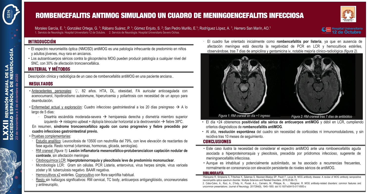 Rombencefalitis antiMOG simulando un cuadro de meningoencefalitis infecciosa