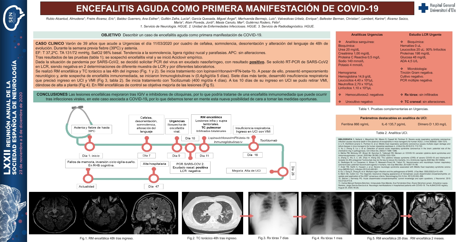 Encefalitis aguda como primera manifestación de COVID-19