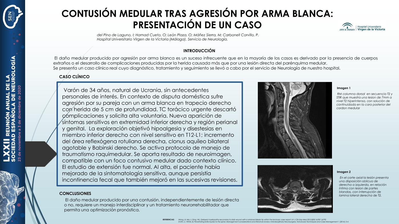 Contusión medular dorsal tras agresión por arma blanca: presentación de un caso
