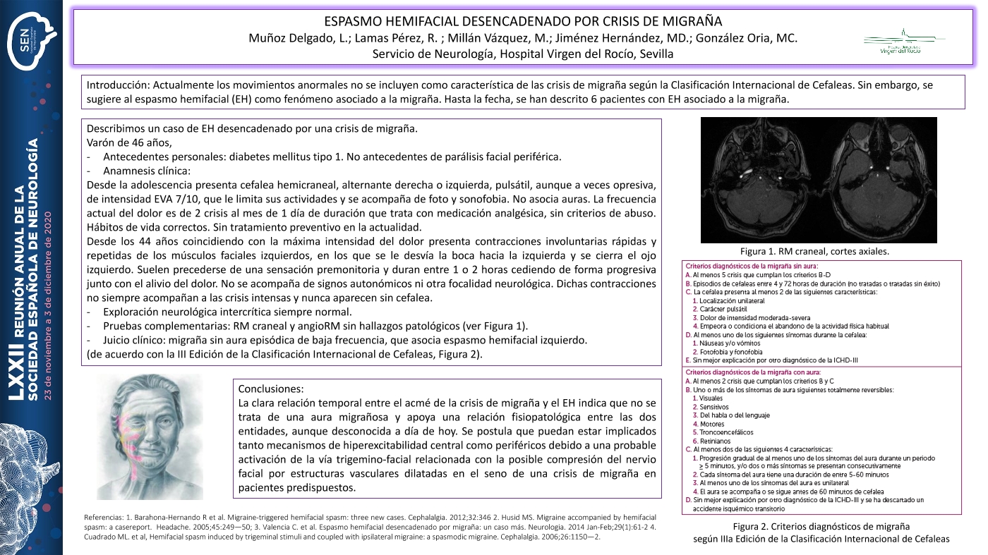 Espasmo hemifacial desencadenado por crisis de migraña