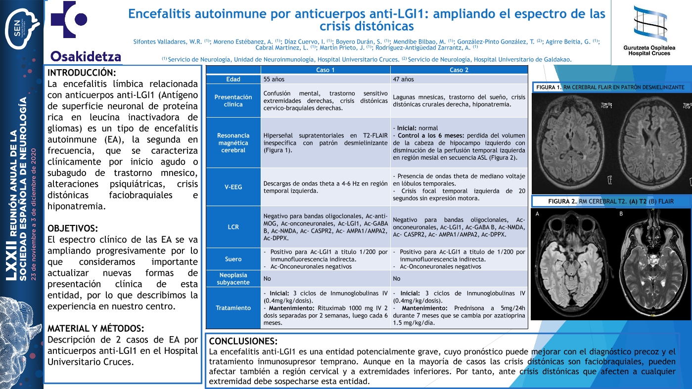 Encefalitis autoinmune por anticuerpos anti-LGI1: ampliando el espectro de las crisis distónicas