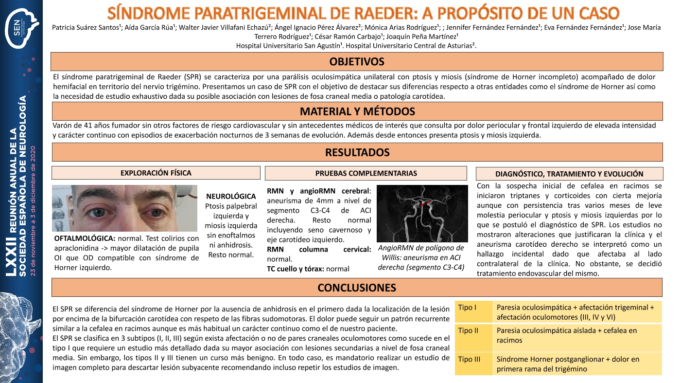 Síndrome paratrigeminal de Raeder: a propósito de un caso