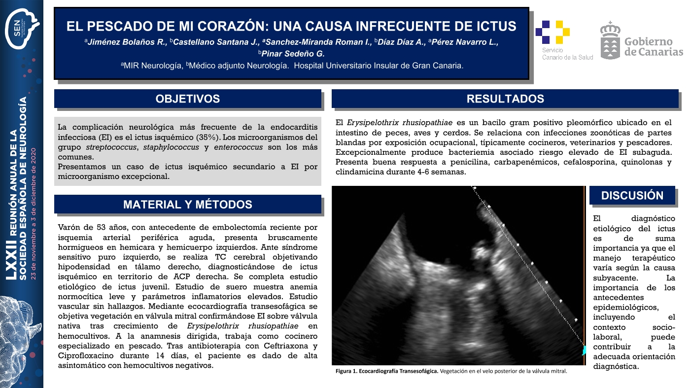 El pescado de mi corazón: una causa infrecuente de ictus