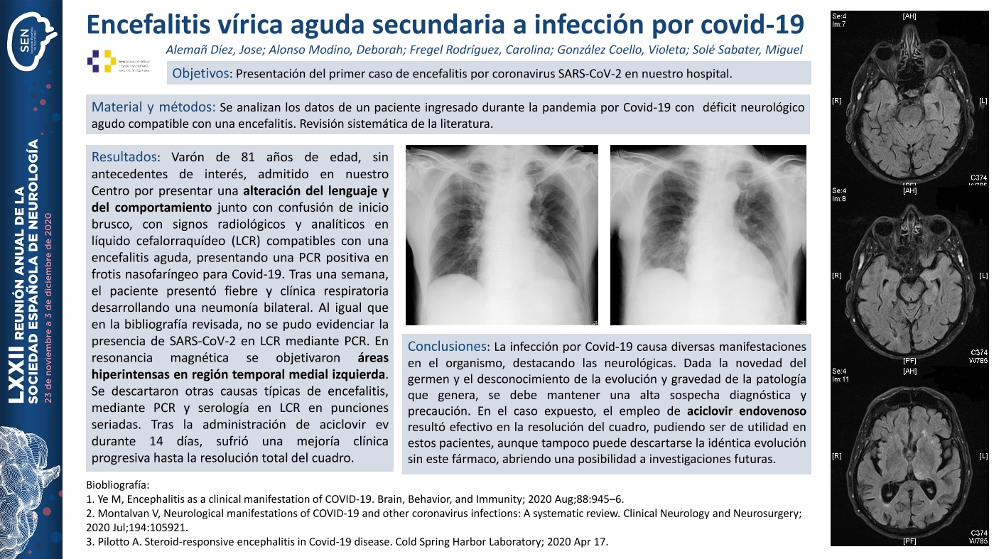Encefalitis vírica aguda secundaria a infección por covid-19