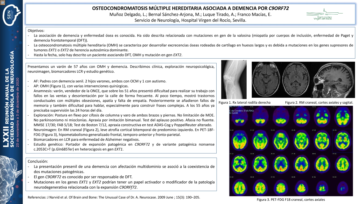 Osteocondromatosis múltiple hereditaria asociada a demencia por C9orf72