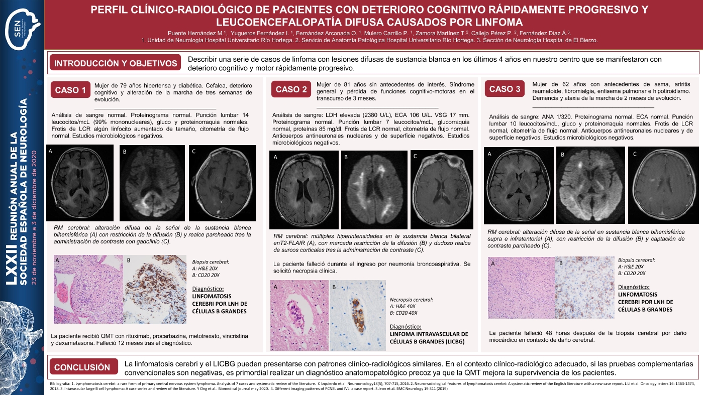 Perfil clínico-radiológico de pacientes con deterioro cognitivo rápidamente progresivo y leucoencefalopatía difusa causados por linfoma