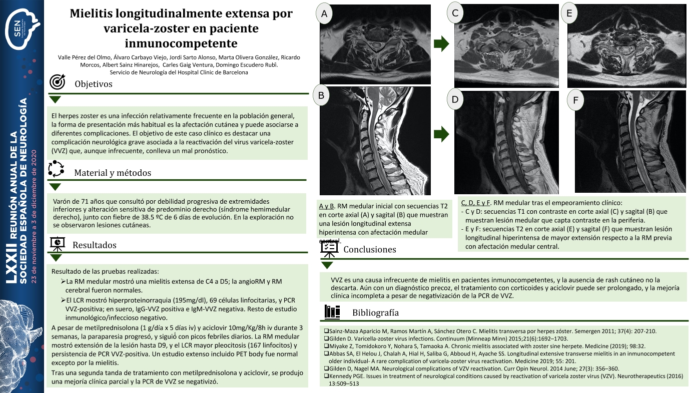 Mielitis longitudinalmente extensa por varicela-zoster en paciente inmunocompetente