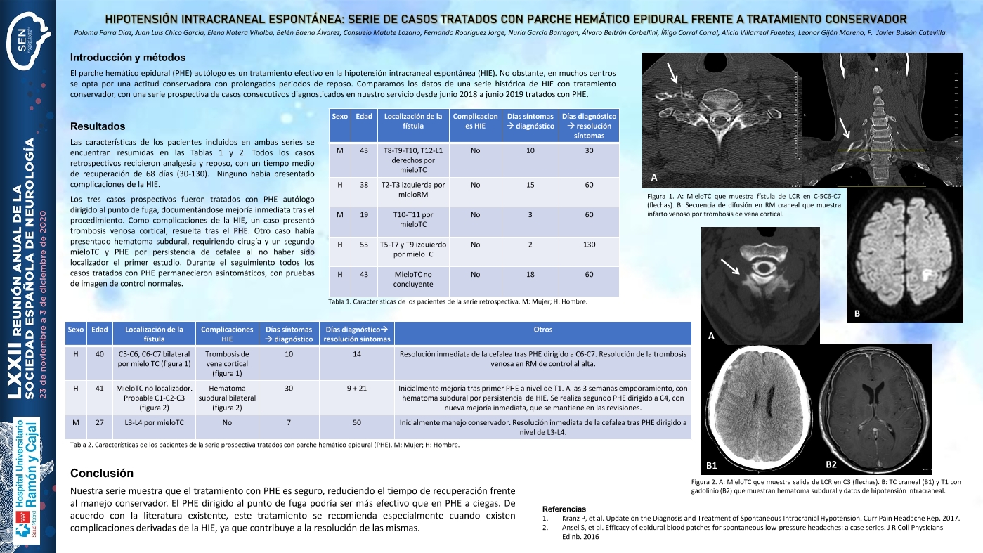 Hipotensión intracraneal espontánea: serie de casos tratados con parche hemático epidural frente a tratamiento conservador