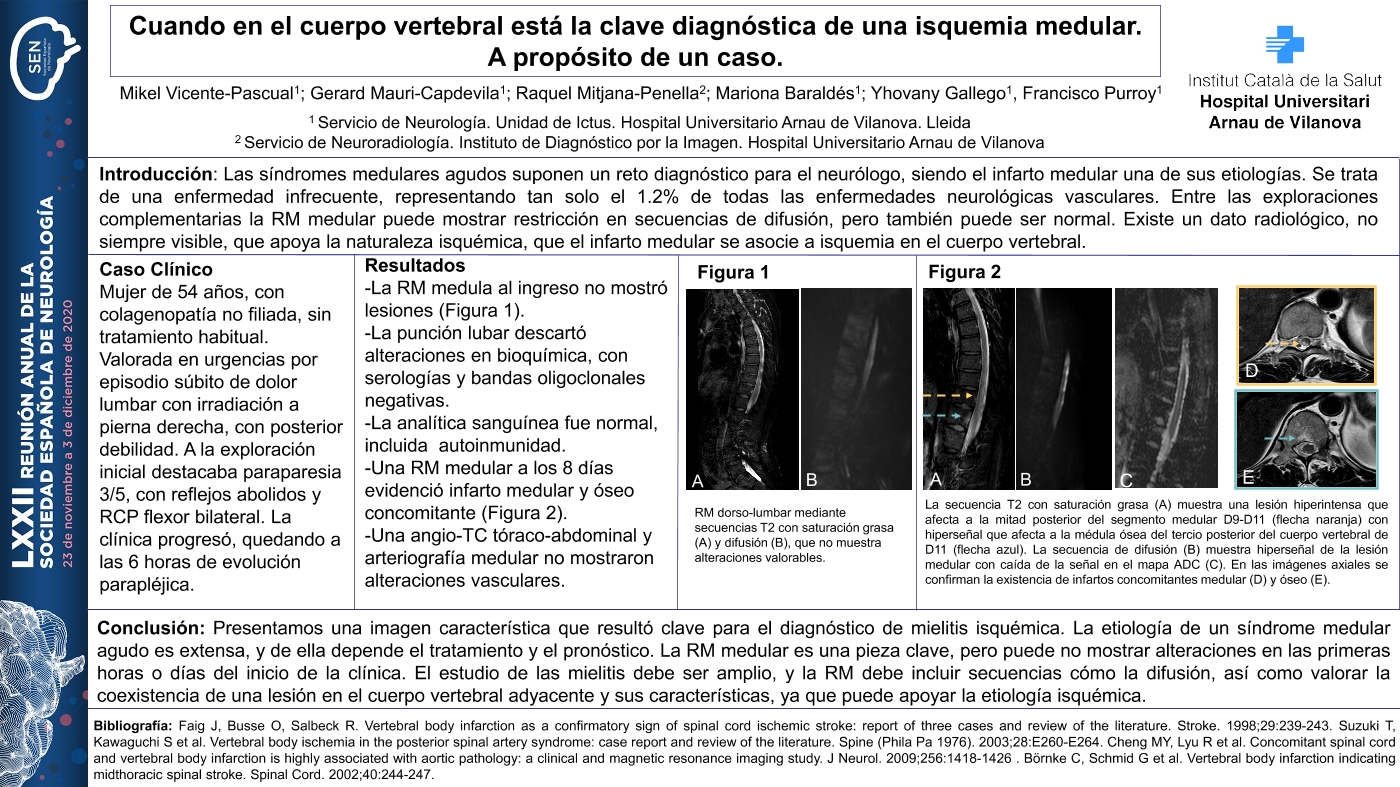 Cuando en el cuerpo vertebral está la clave diagnóstica de una isquemia medular. A propósito de un caso.