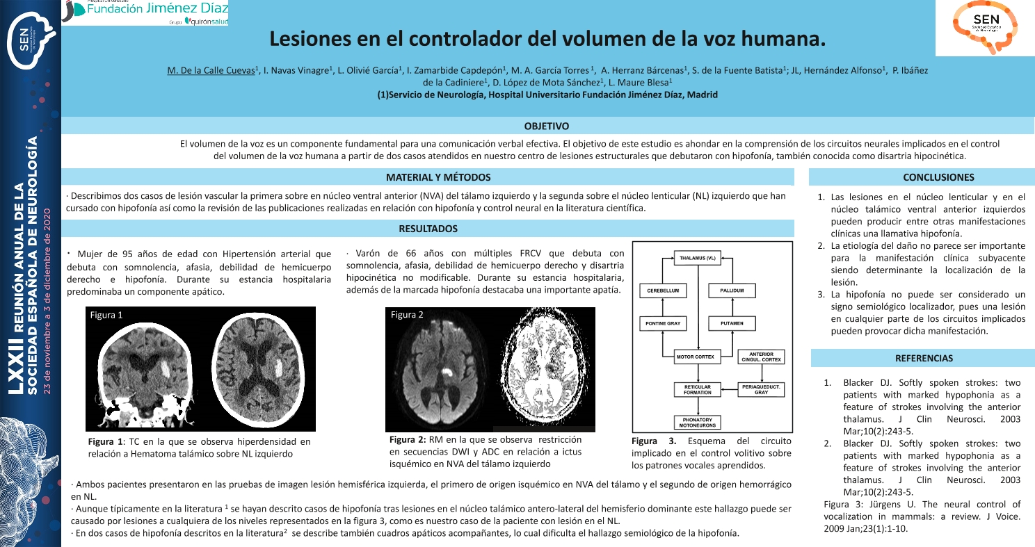 Lesiones en el controlador del volumen de la voz humana