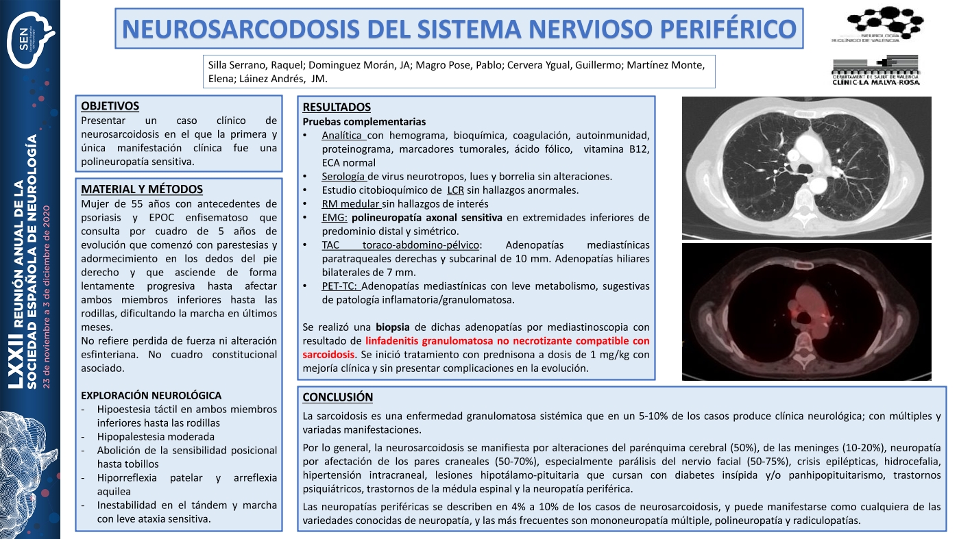 Neurosarcoidosis del sistema nervioso periférico