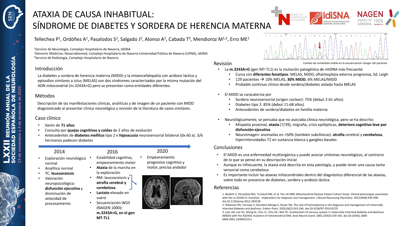 Ataxia de causa inhabitual: síndrome de diabetes y sordera de herencia materna