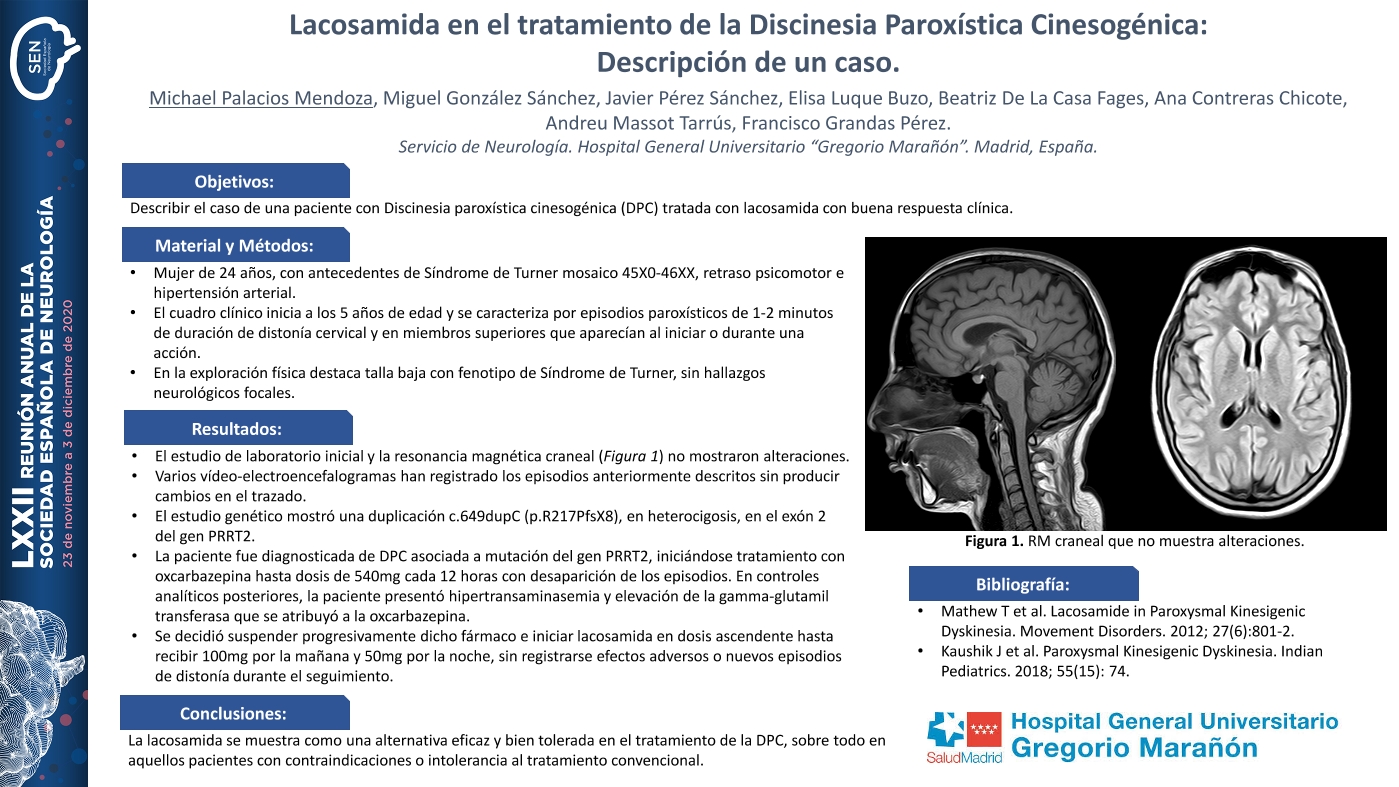 Lacosamida en el tratamiento de la Discinesia paroxística cinesogénica: Descripción de un caso.