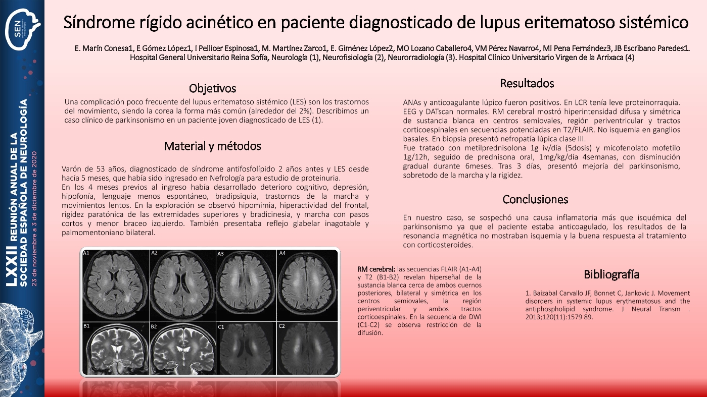 Síndrome rígido-acinético en paciente diagnosticado de lupus eritematoso sistémico