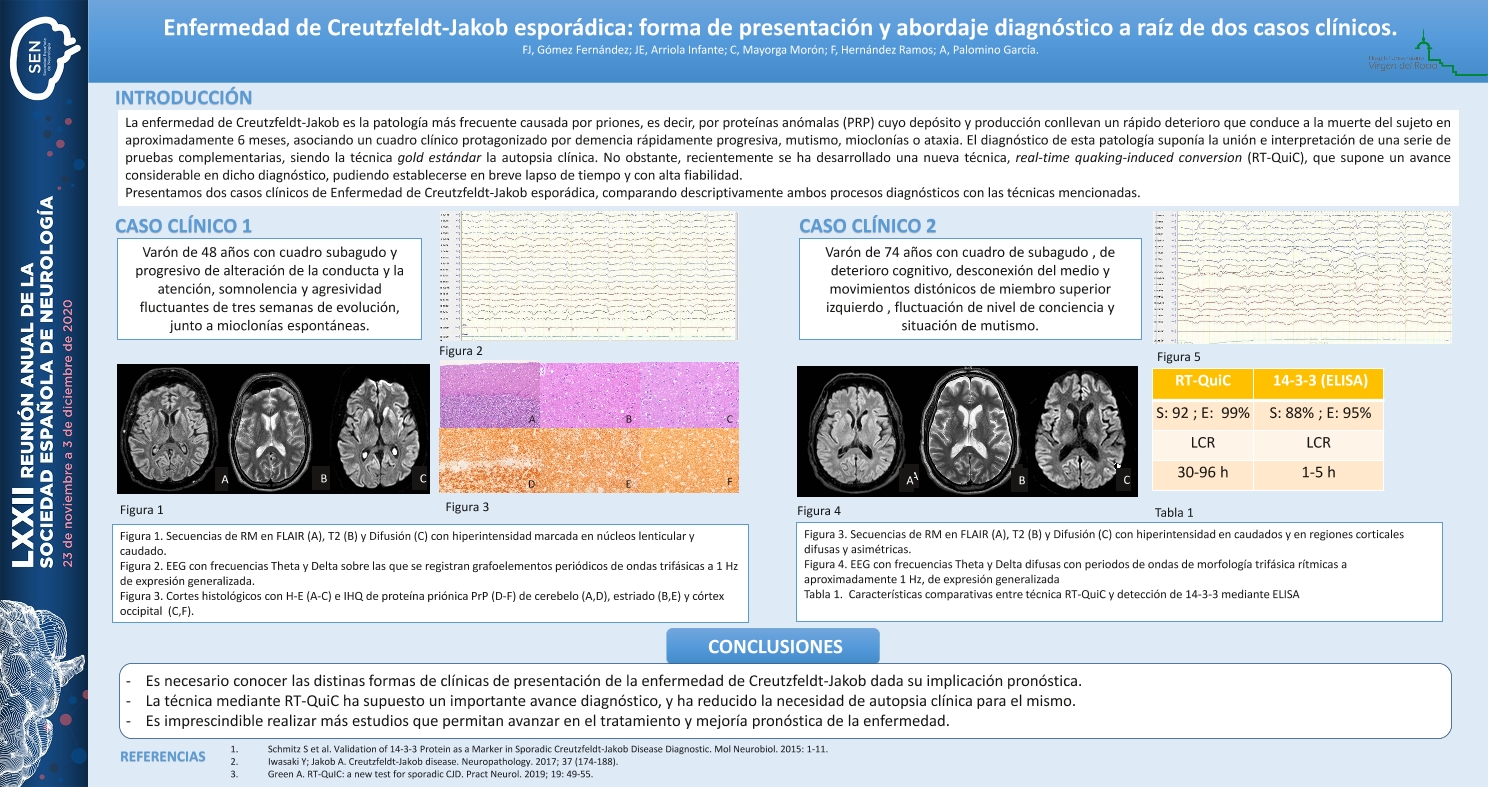 Enfermedad de Creutzfeldt-Jakob esporádica: forma de presentación y abordaje diagnóstico a raíz de dos casos clínicos.