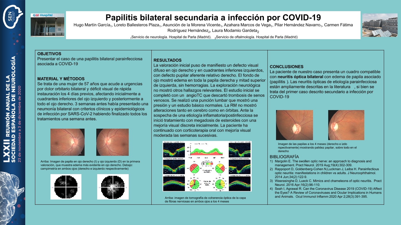 Papilitis bilateral secundaria a Covid-19