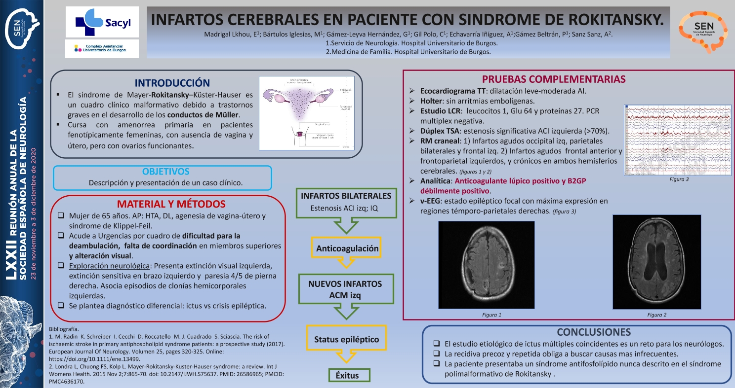 Infartos cerebrales en paciente con síndrome de Rokitansky