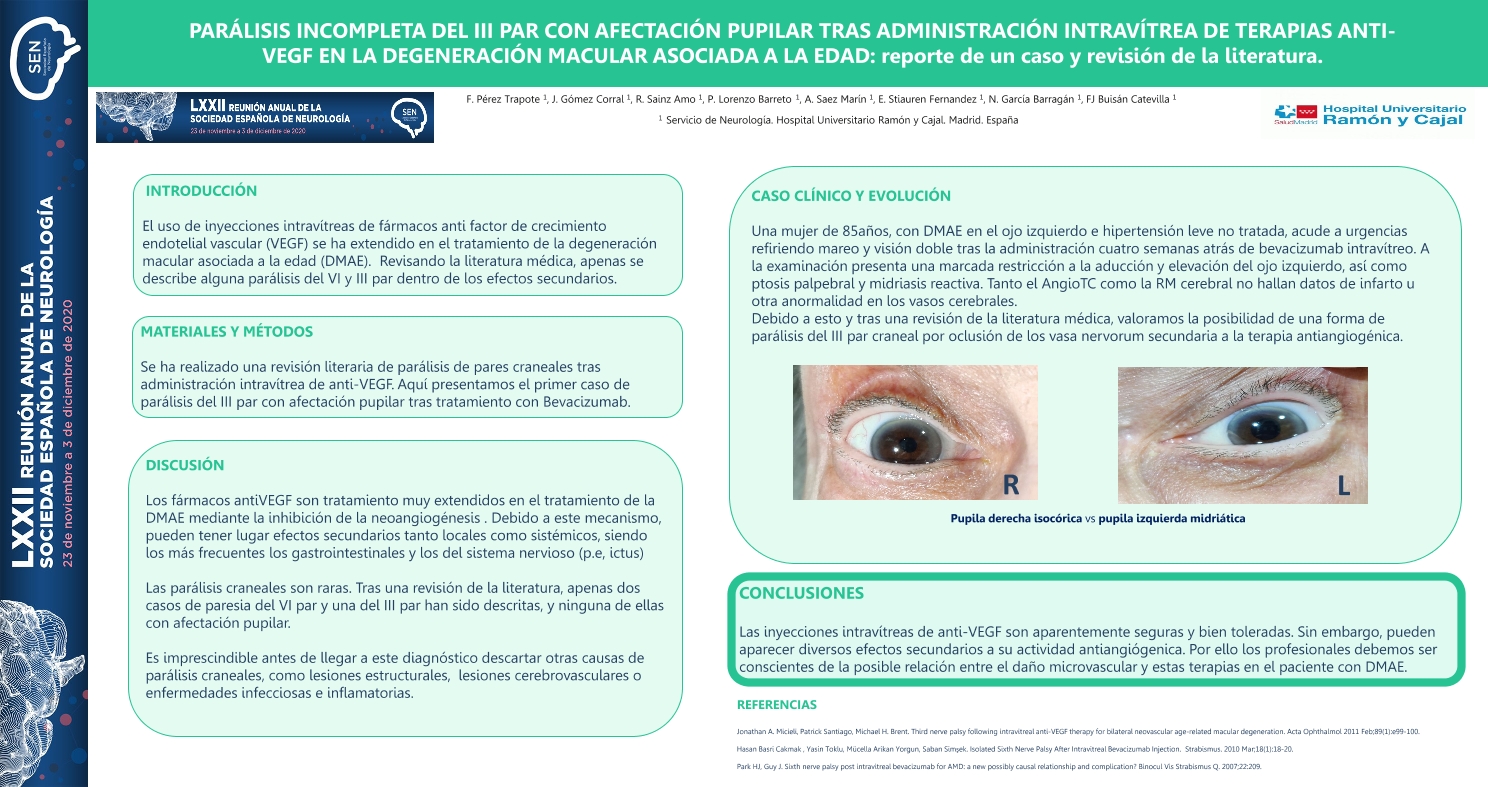 Parálisis incompleta del III par con afectación pupilar tras administración intravítrea de terapias anti-VEGF en la degeneración macular asociada a la edad: reporte de caso y revisión de la literatura