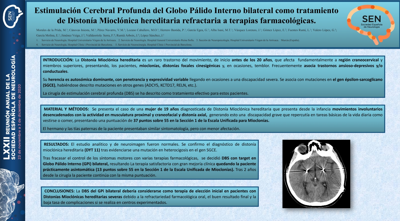 Estimulación Cerebral Profunda del Globo Pálido Interno bilateral como tratamiento de Distonía Mioclónica hereditaria refractaria a terapias farmacológicas