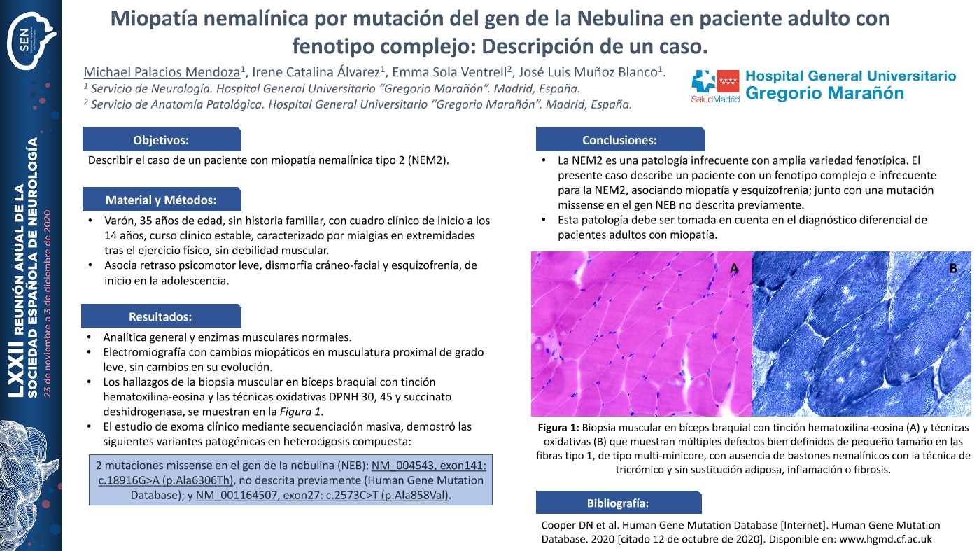 Miopatía nemalínica por mutación del gen de la Nebulina en paciente adulto con fenotipo complejo: Descripción de un caso.