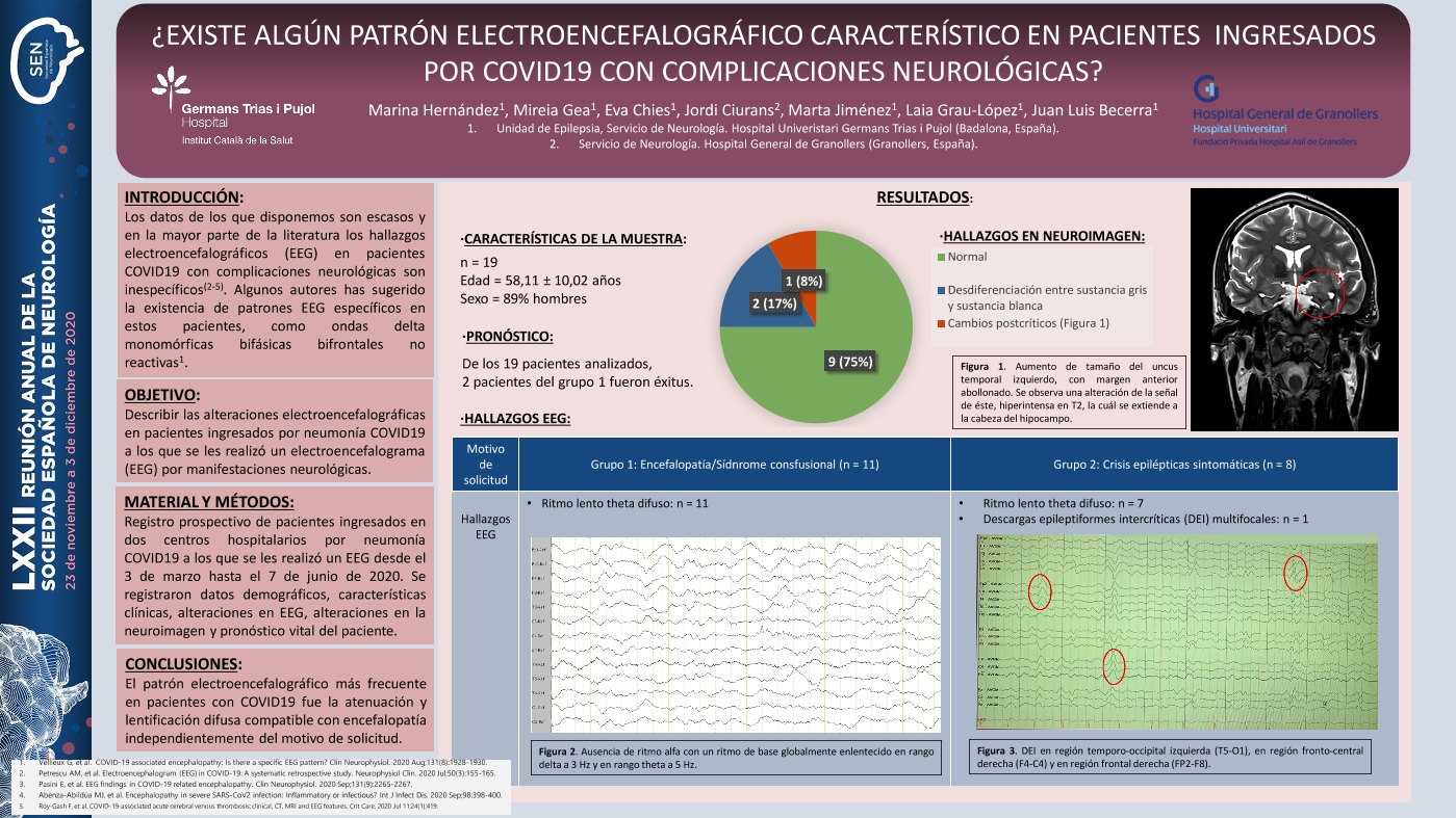 ¿Existe algún patrón electroencefalográfico característico en pacientes  ingresados por COVID19 con complicaciones neurológicas?