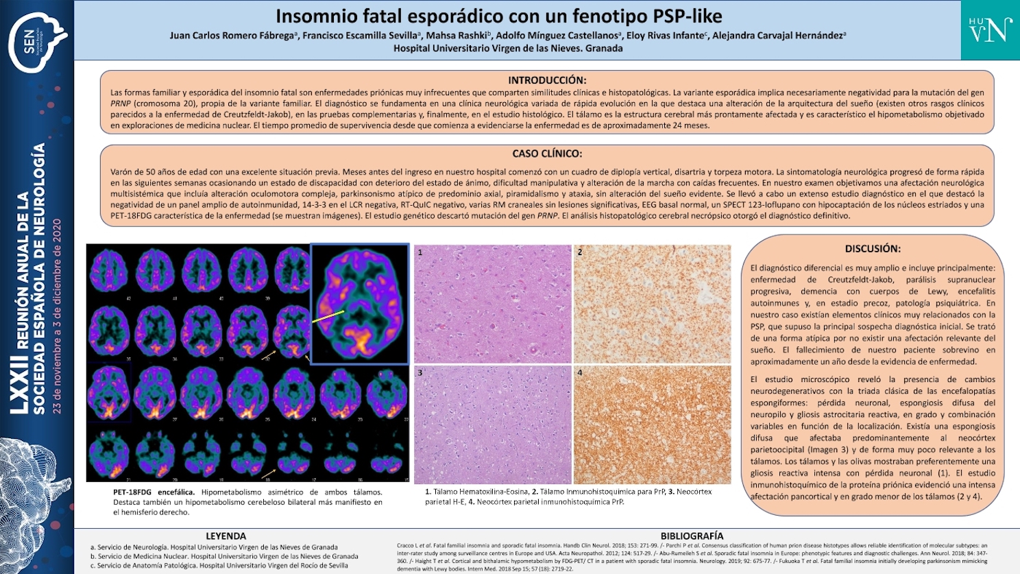 Insomnio fatal esporádico con un fenotipo PSP-like