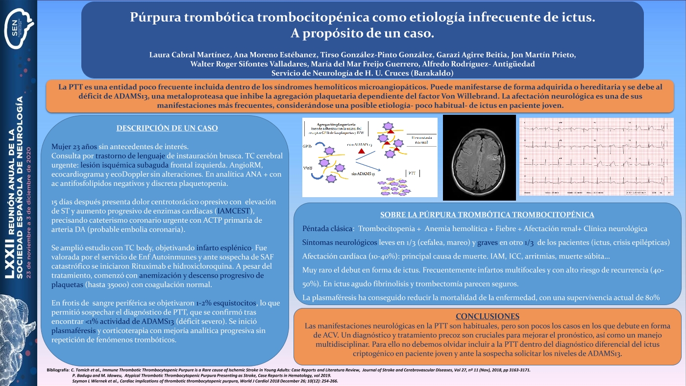 Púrpura trombótica trombocitopénica como etiología infrecuente de ictus. A propósito de un caso