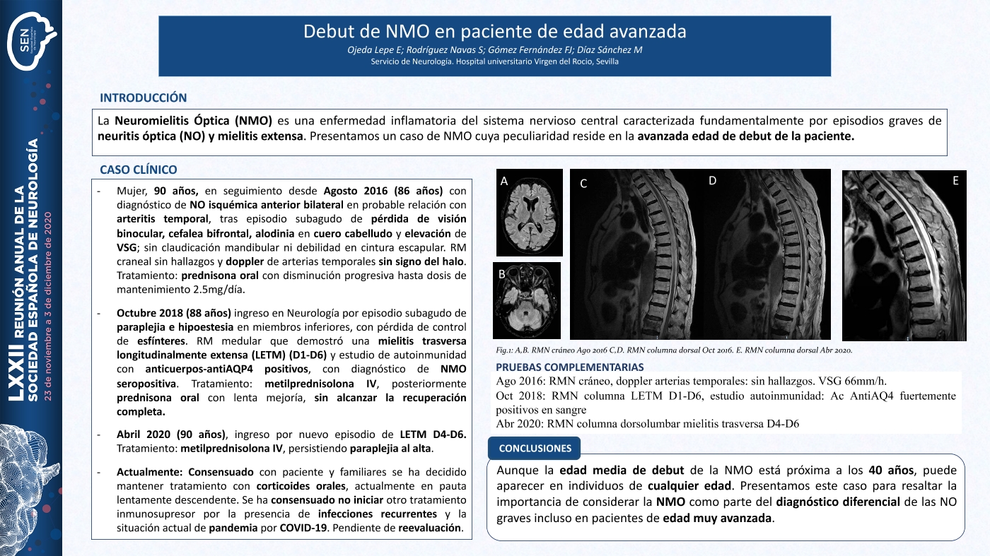 Debut de NMO en paciente de edad avanzada