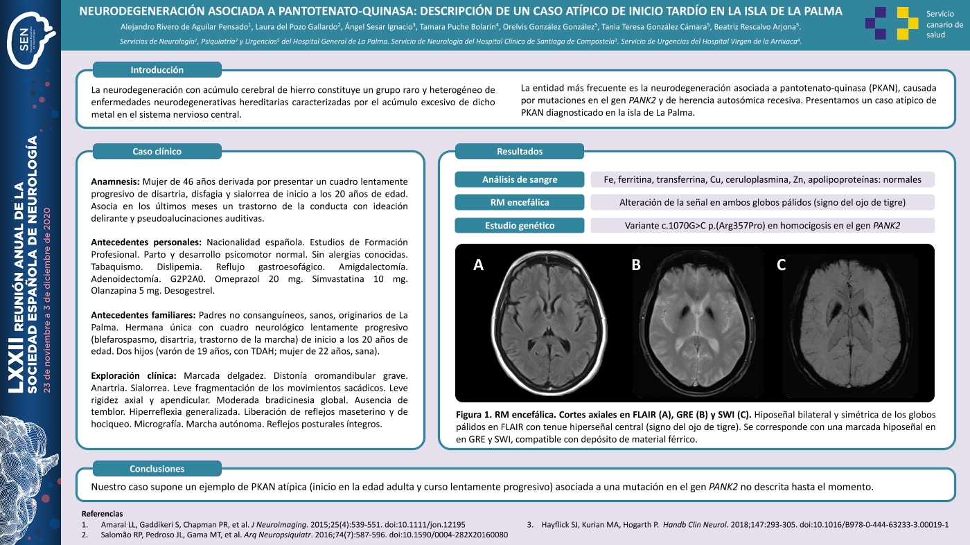 Neurodegeneración asociada a pantotenato-quinasa: descripción de un caso atípico de inicio tardío en la isla de La Palma