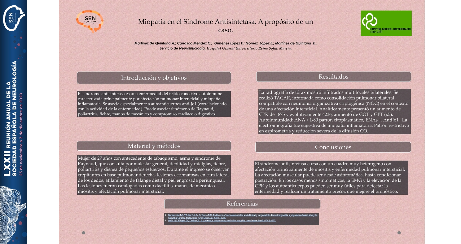 Miopatía en el Síndrome Antisintetasa. A propósito de un caso.