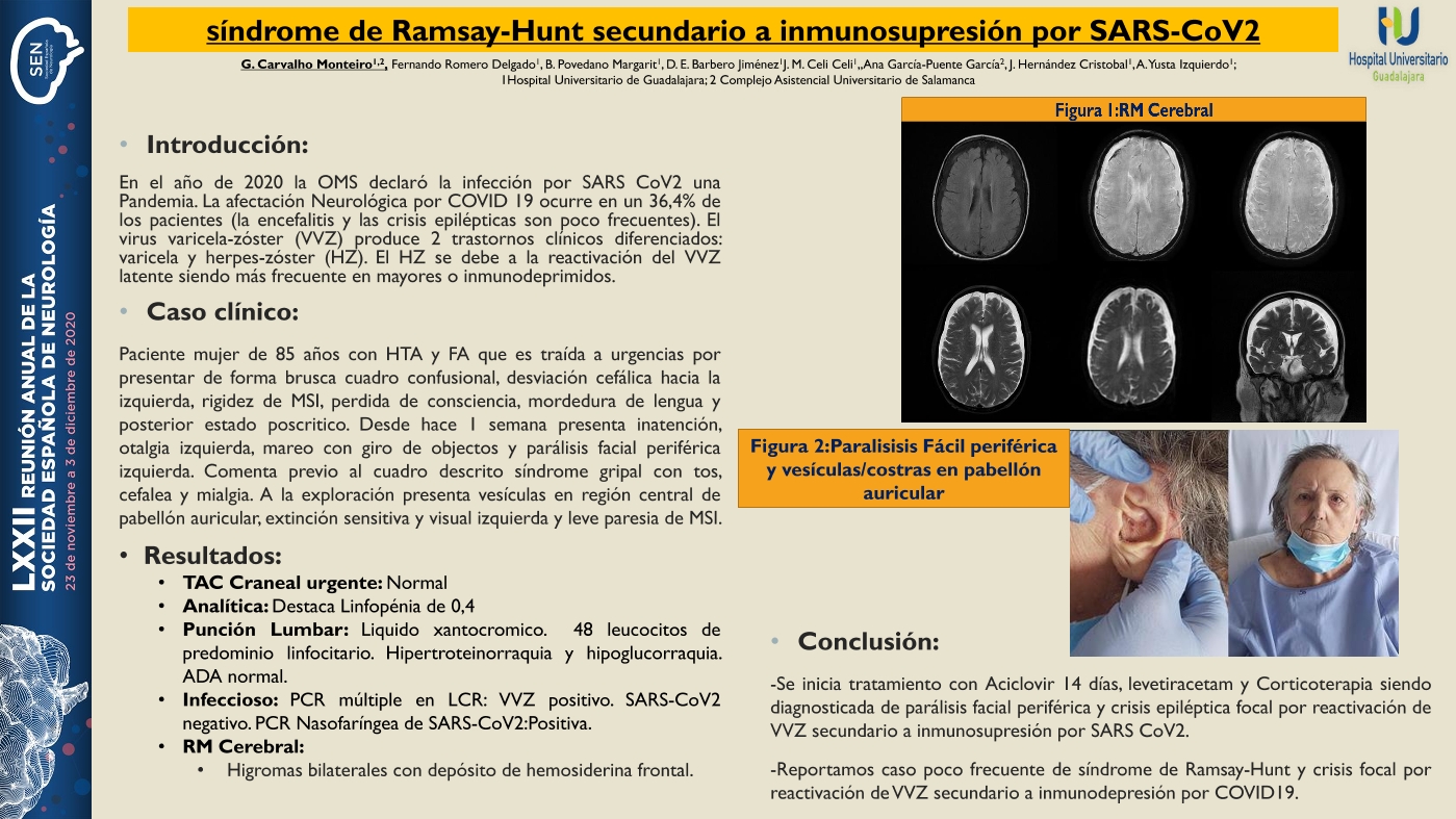 Síndrome de Ramsay- Hunt secundario a inmunosupresión por SARS-CoV2